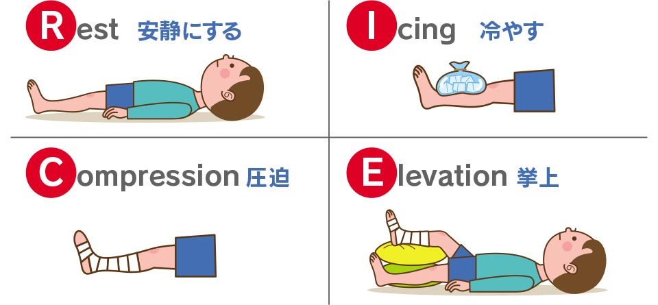 「Rest＝安静」「Icing＝冷却」「Compression=圧迫」「Elevation＝挙上」