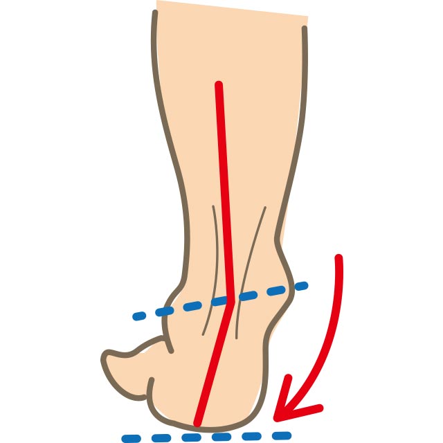 立った状態を後ろから見て、かかとが外側に広がっている